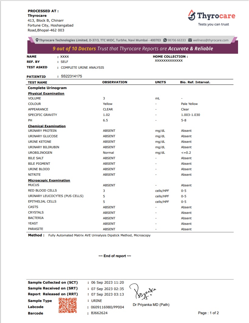 Complete Urine Analysis Test Sample Report