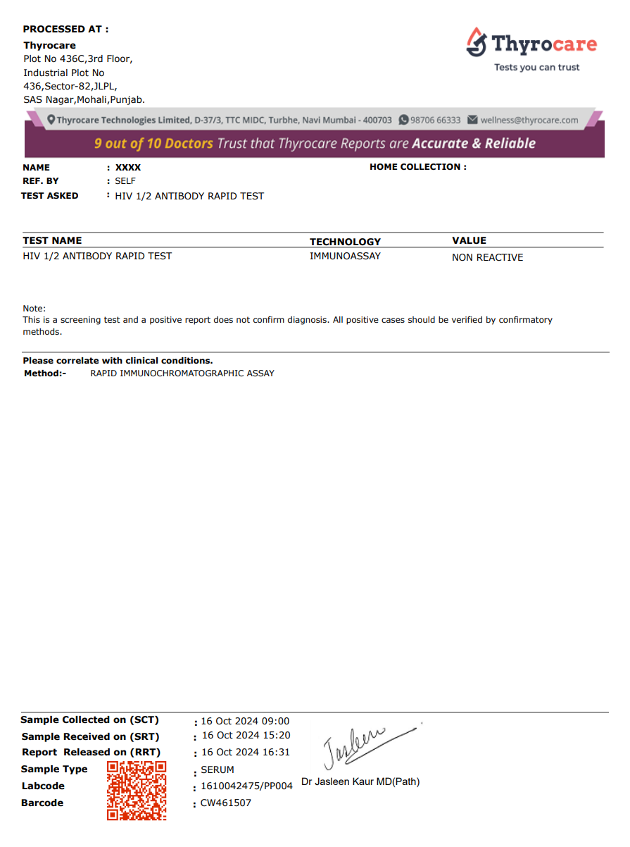 HIV 1 & 2 Antibody Rapid Test Sample Report