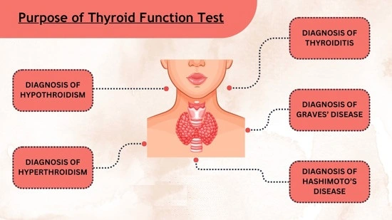 Thyroid test purpose