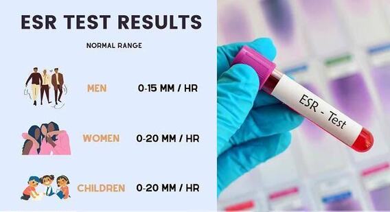 ESR Test normal range in hindi