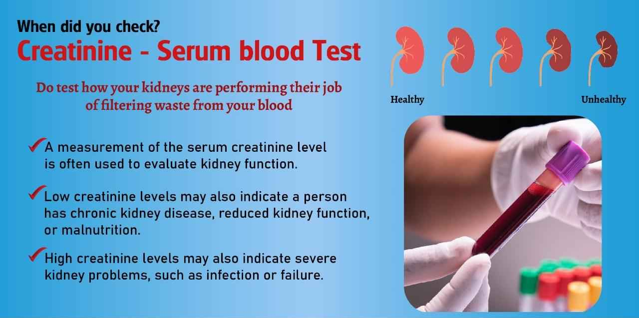 Creatinine serum test