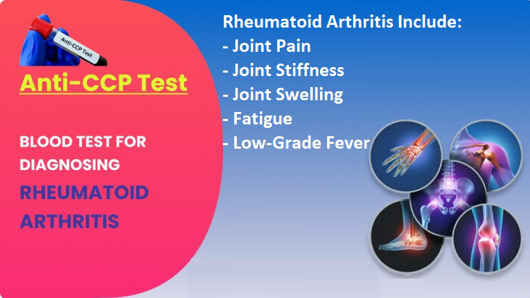 Symptoms of Rheumatoid Arthritis