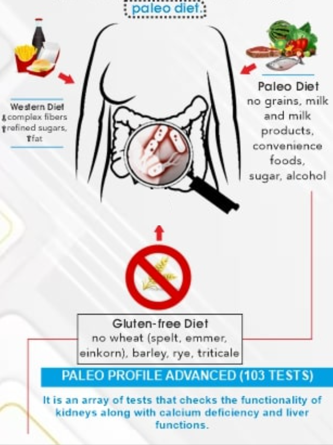 Paleo Diet- Gluten Free Diet