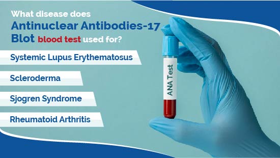 ANA (Antinuclear Antibodies 17) Blot Test