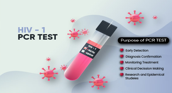 Purpose of HIV 1 RNA PCR blood test