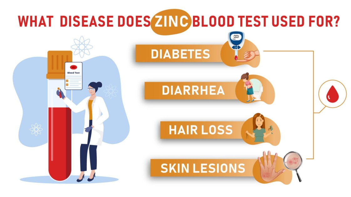 uses of zinc blood test