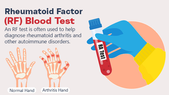 ra factor blood test