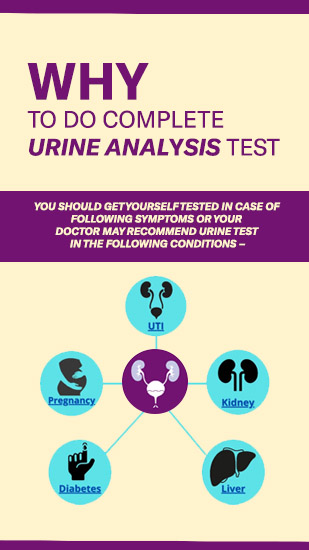 Complete urine test