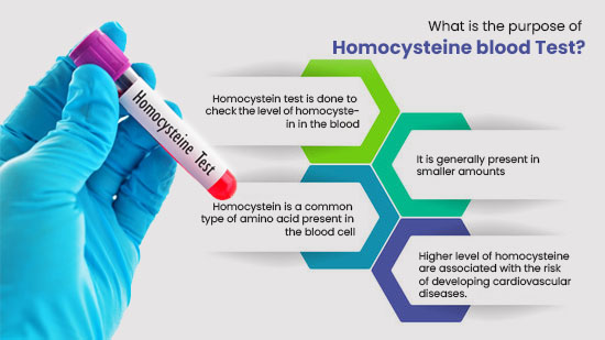 homocysteine blood test