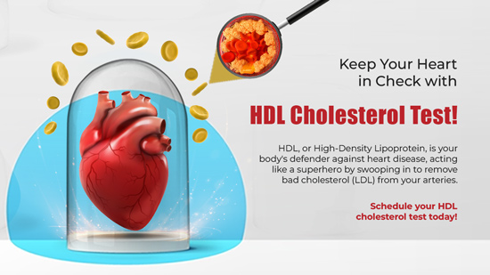 importance of HDL Choesterol