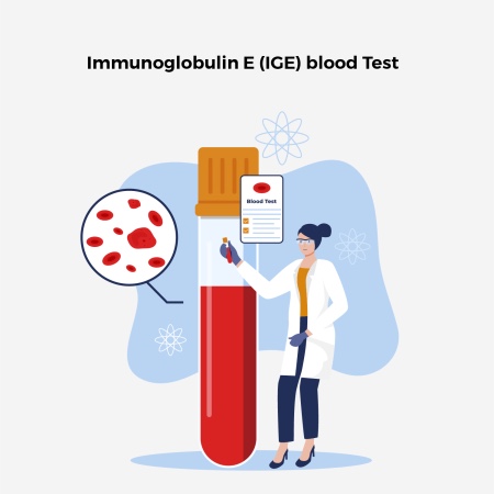 Immunoglobulin E (IGE) blood Test