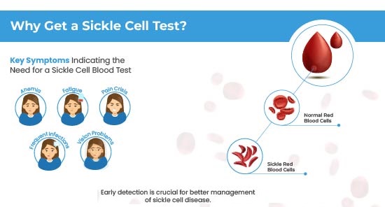 Sickle Blood Test