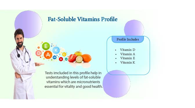 Fat Soluble vitamins test