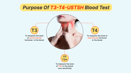 t3 t4 tsh purpose