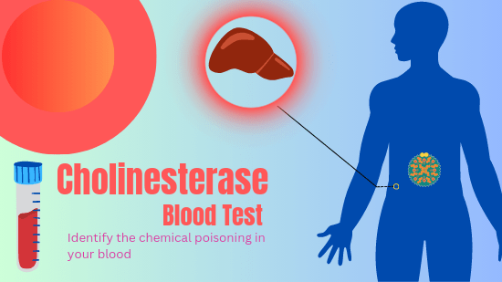 cholinesterase test used for