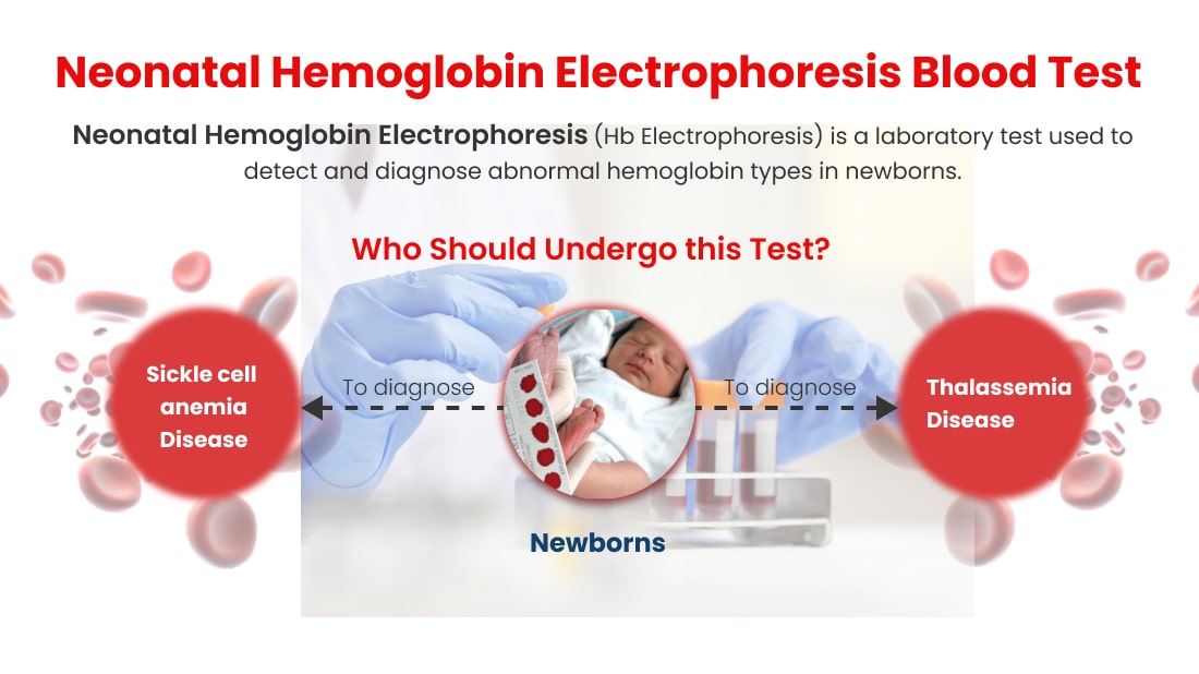 Neonatal Hemoglobin Electrophoresis Blood Test