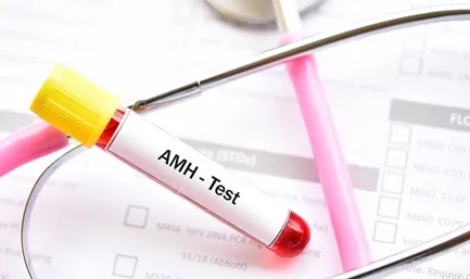 AMH Test Sample Report